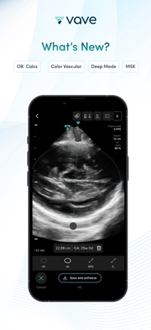 Vave Health screenshot
