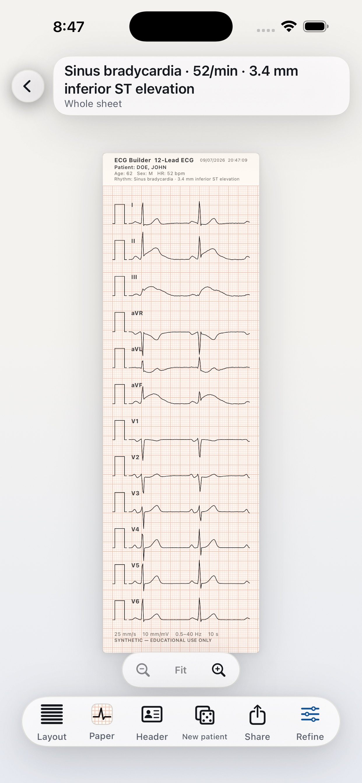 Screenshot 2 of ECG Builder