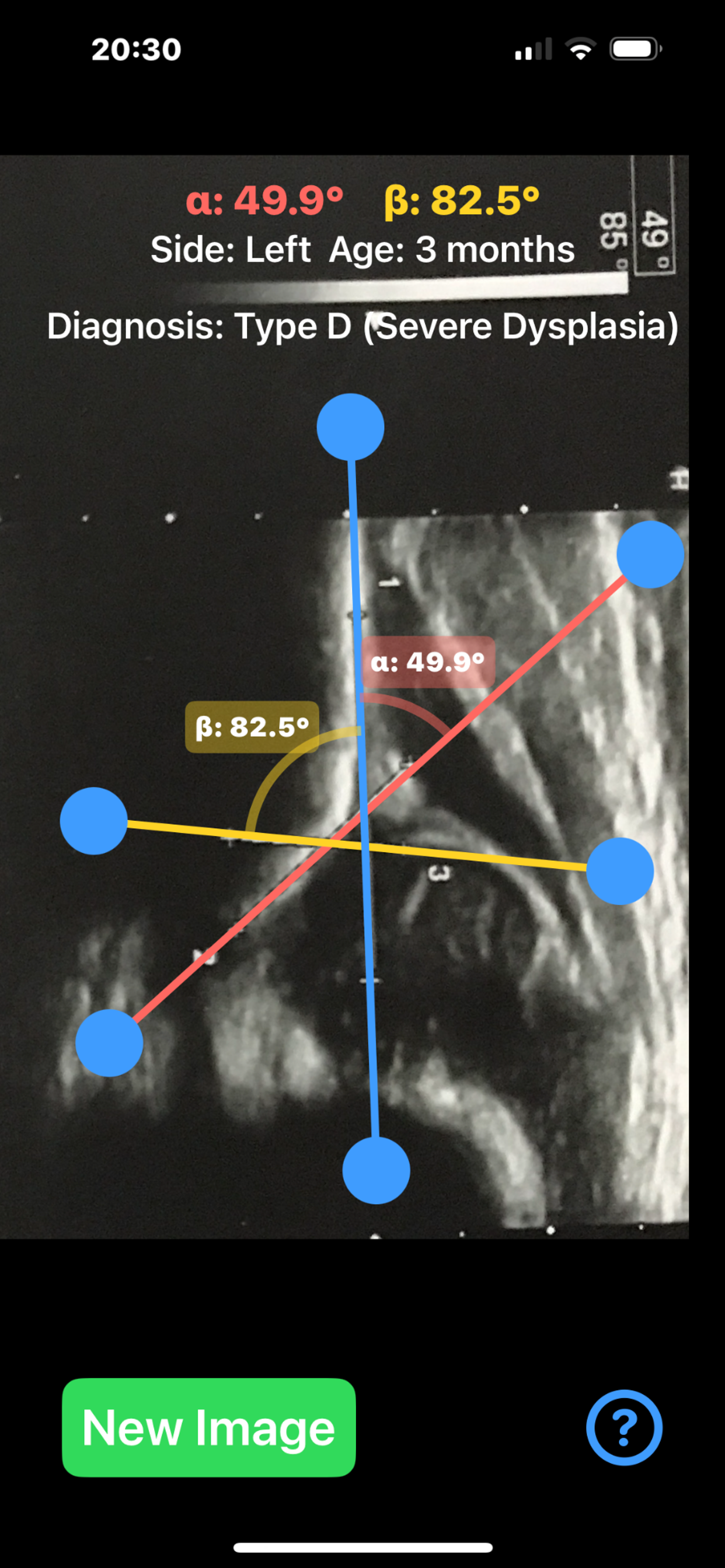 SonoHipAngles screenshot 10