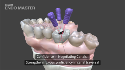 Dental EndoMaster Screenshot