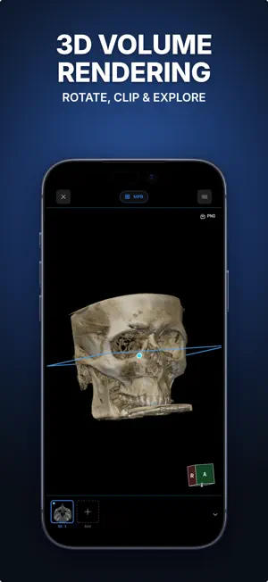Ossidex: DICOM Viewer CT & MRI screenshot 3