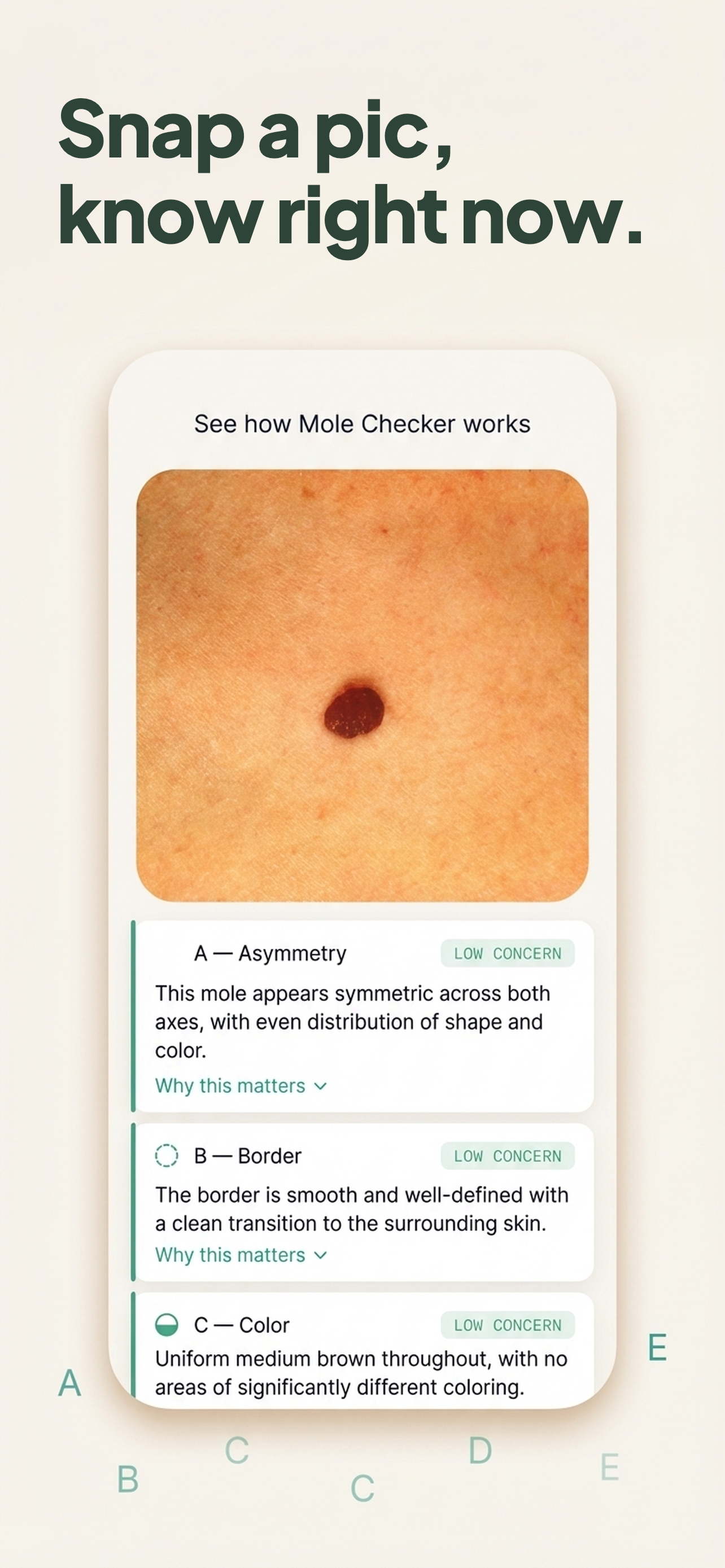 Mole Checker: Skin Scanner screenshot 3