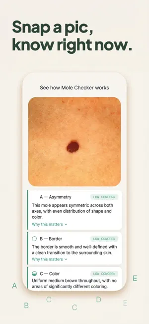 Mole Checker: Skin Scanner screenshot 3
