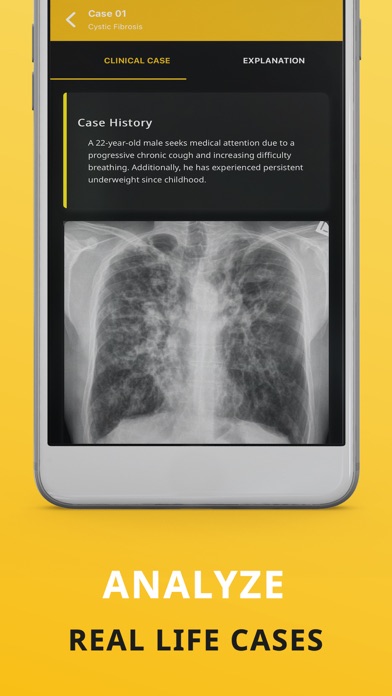 Chest X-ray (CXR) Made Easy Screenshot