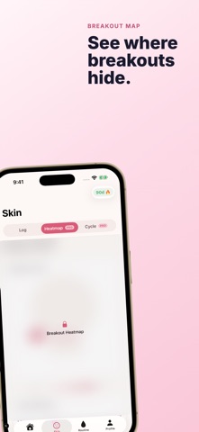Acne Tracker - Clarity Screenshot 3 of 5