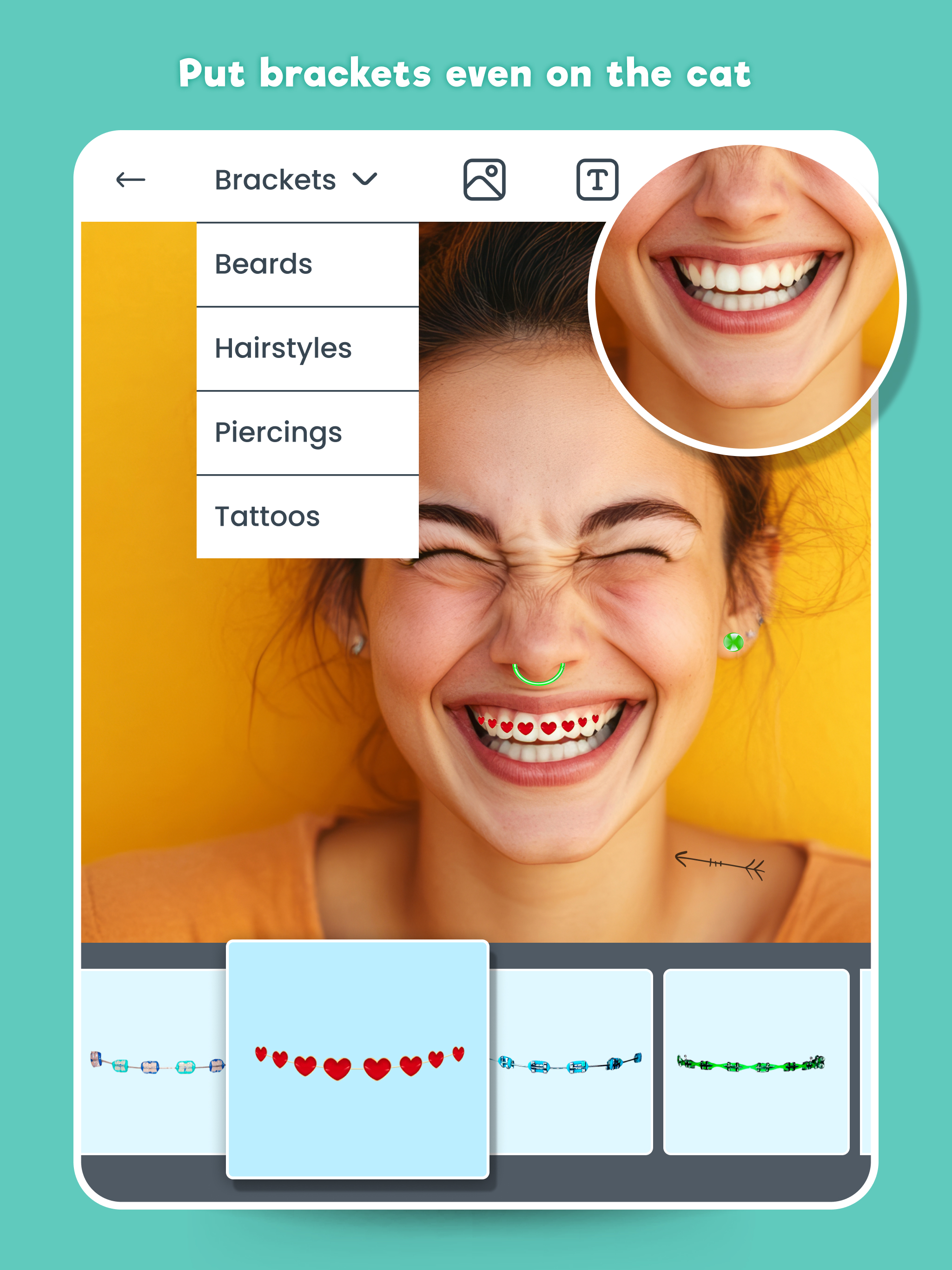 Braces Photo Editor - Stickers