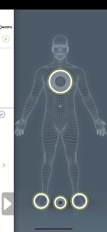 Surestep Scan iPhone screenshot