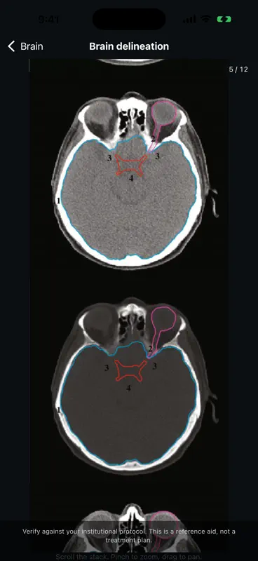 Isodose RT screenshot 6 of 6