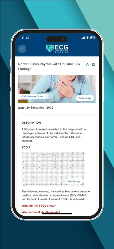 ECG Expert screenshot 3 of 4