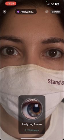 PupiLUX:Pupillary Light Reflex screenshot