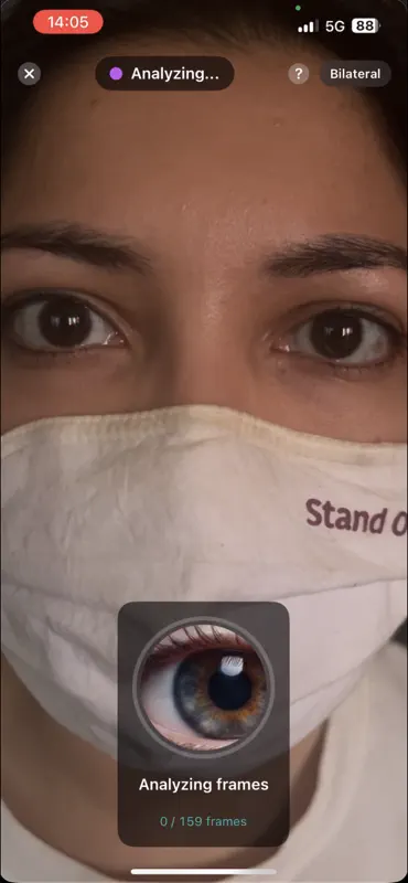 PupiLUX:Pupillary Light Reflex screenshot 6 of 10