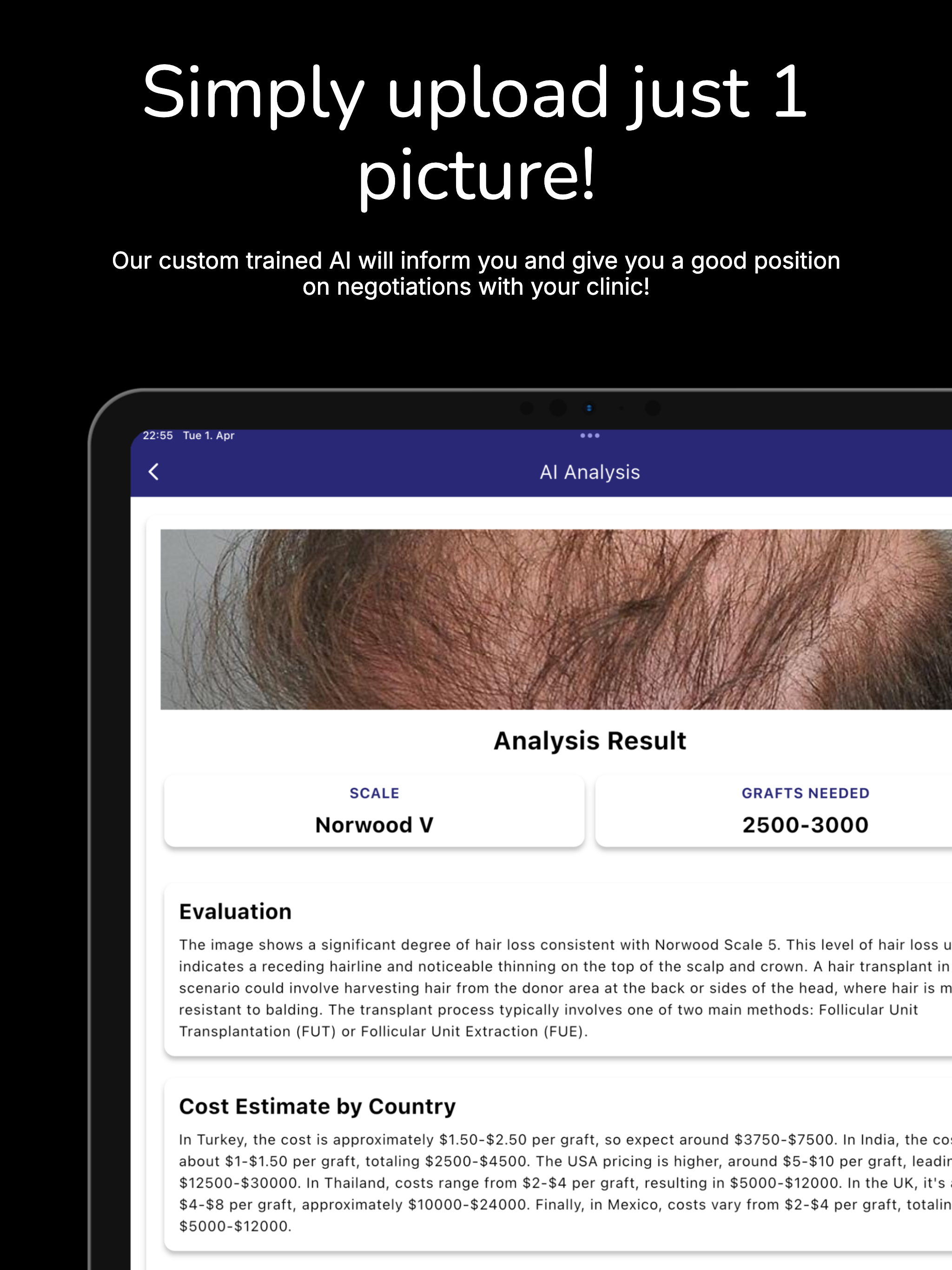 Hair Transplant AI Cost Expert