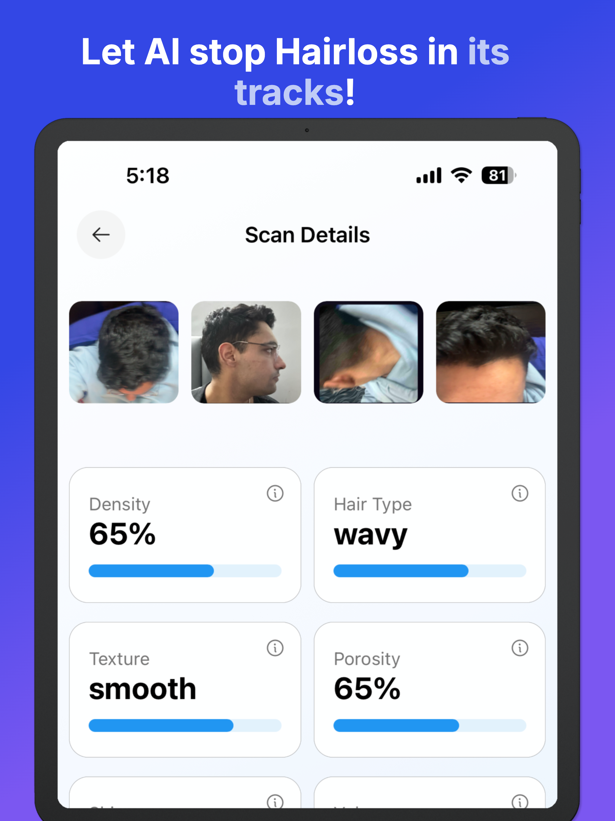 Hairmaxx: Health & Style Scan