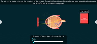 Vision Defects – EduTech Era iPhone screenshot
