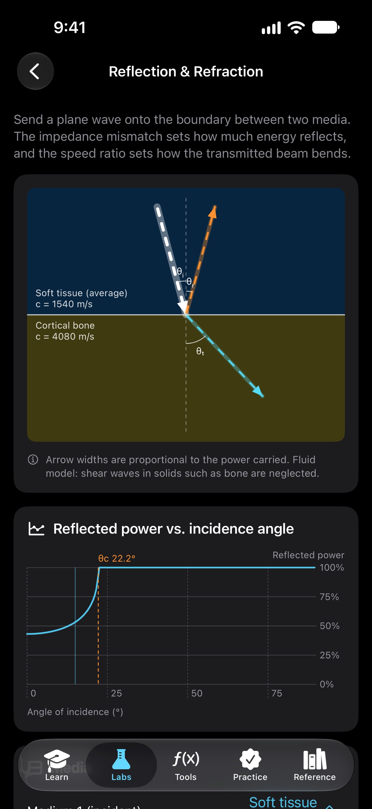 Screenshot 4 of Ultrasound Fundamentals