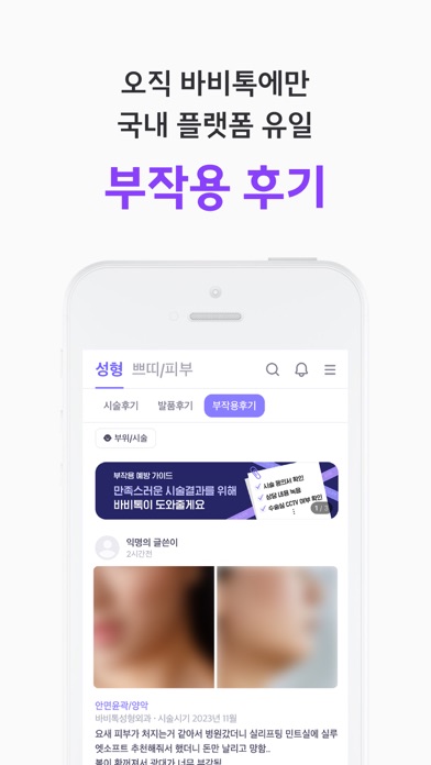 바비톡 - 800만이 선택한 대표 성형·시술 플랫폼 Screenshot