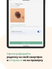 Про Родинки: здоровая кожа айпад изображения 2