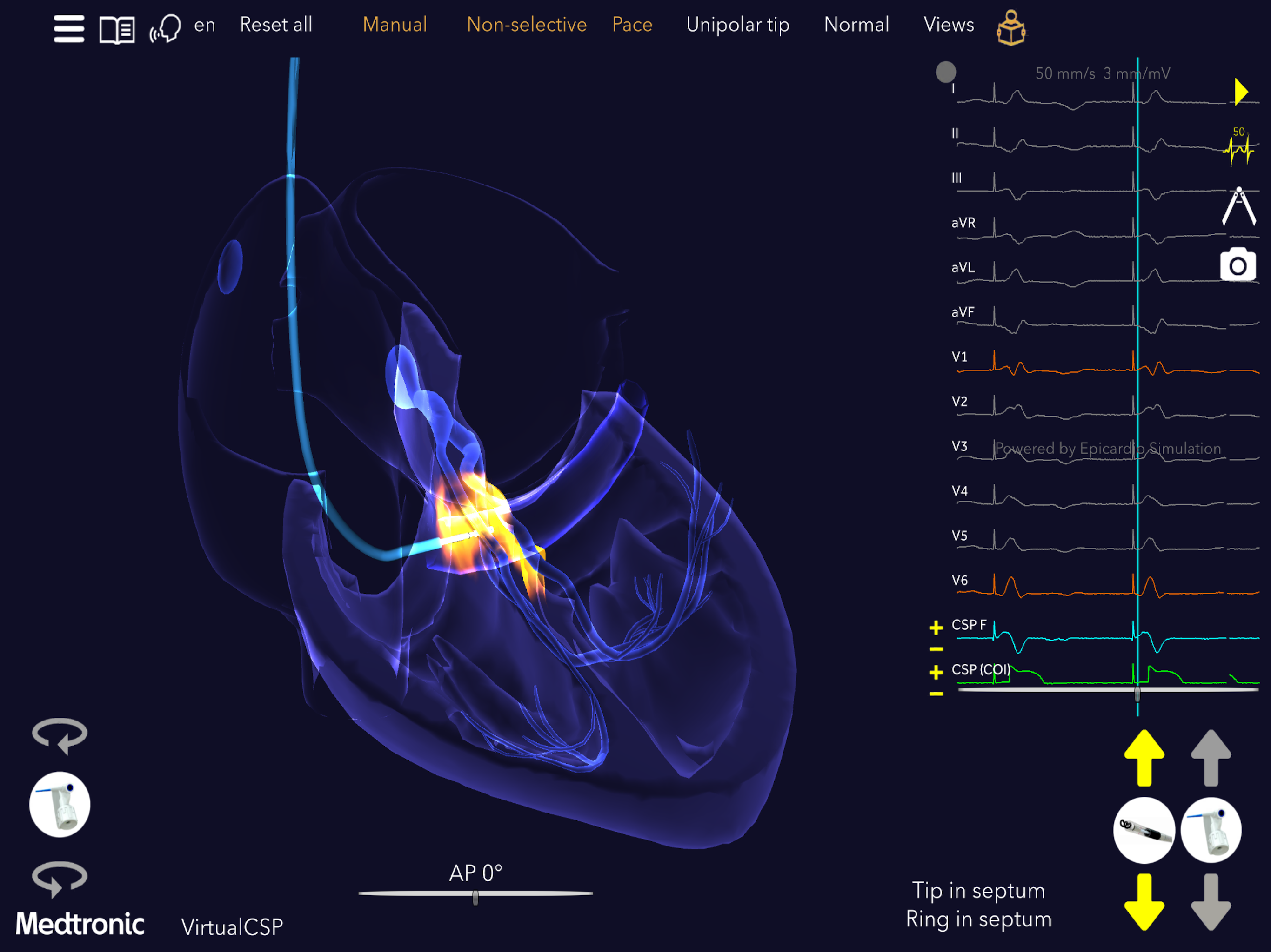 Medtronic VirtualPulse screenshot 15