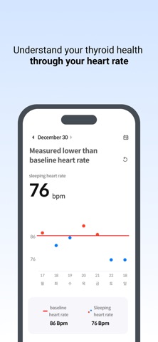 Glandy iPhone screenshot