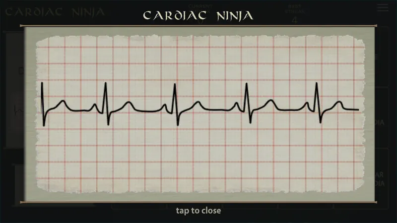 Cardiac Ninja screenshot 2 of 7
