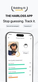 Hair Loss Tracker - BaldingAI screenshot