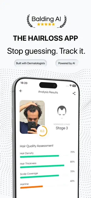 Hair Loss Tracker - BaldingAI screenshot 1