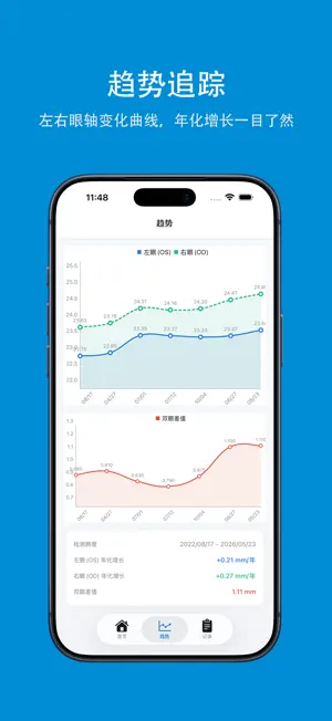 视力宝 - 眼轴数据管家 screenshot 3
