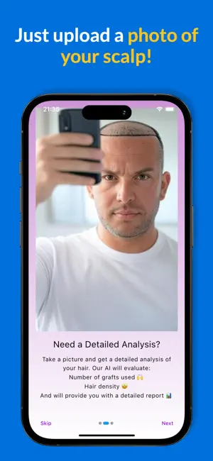 Graft Count - Hair Transplant screenshot 4