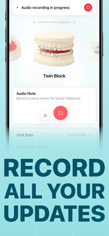 Bracie - Orthodontic Tracker Screenshot 5 of 8