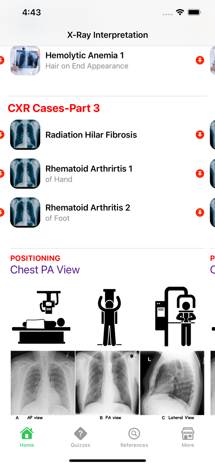 X-Ray Interpretation Guide