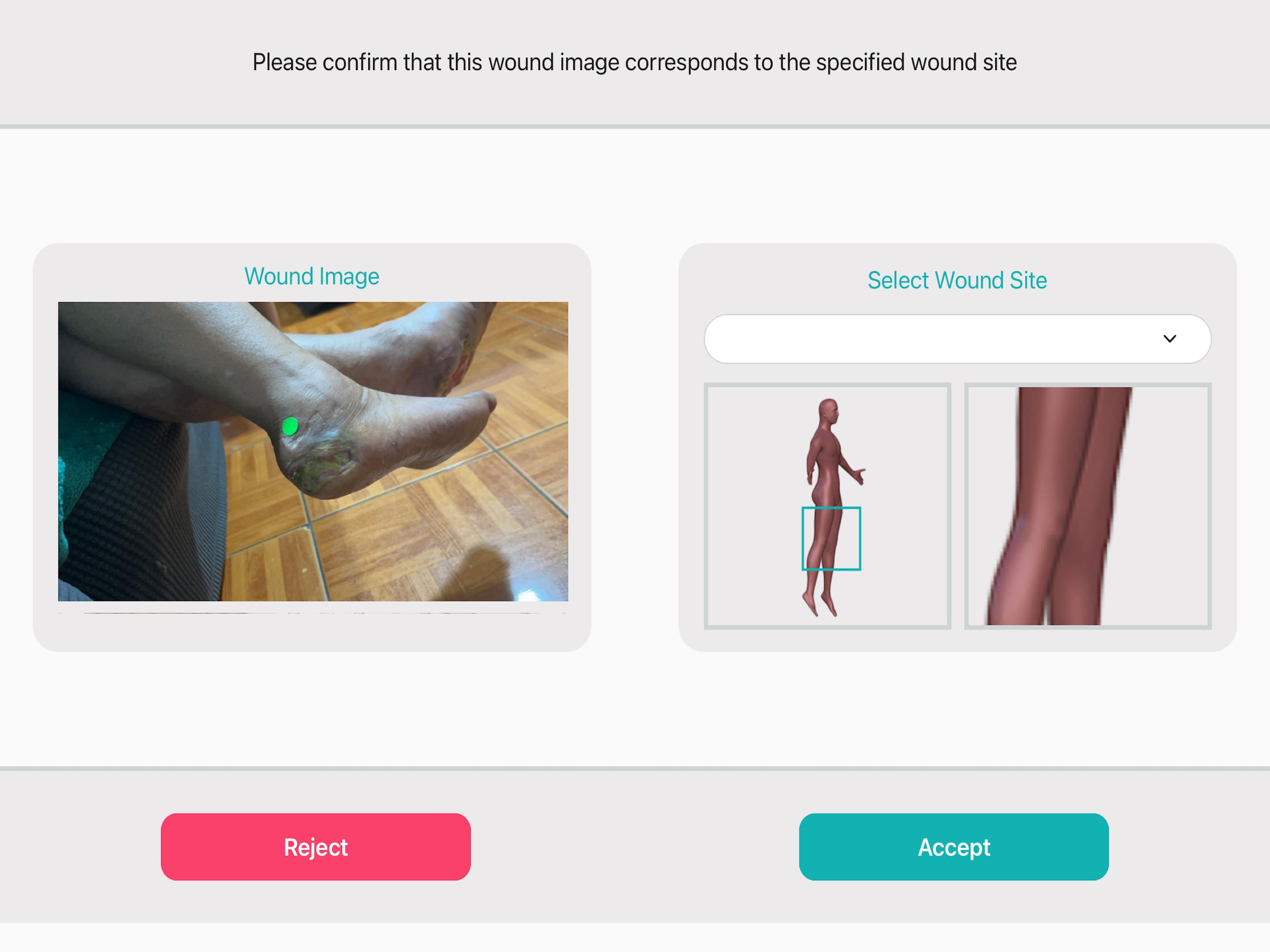 WoundMatrix Patient