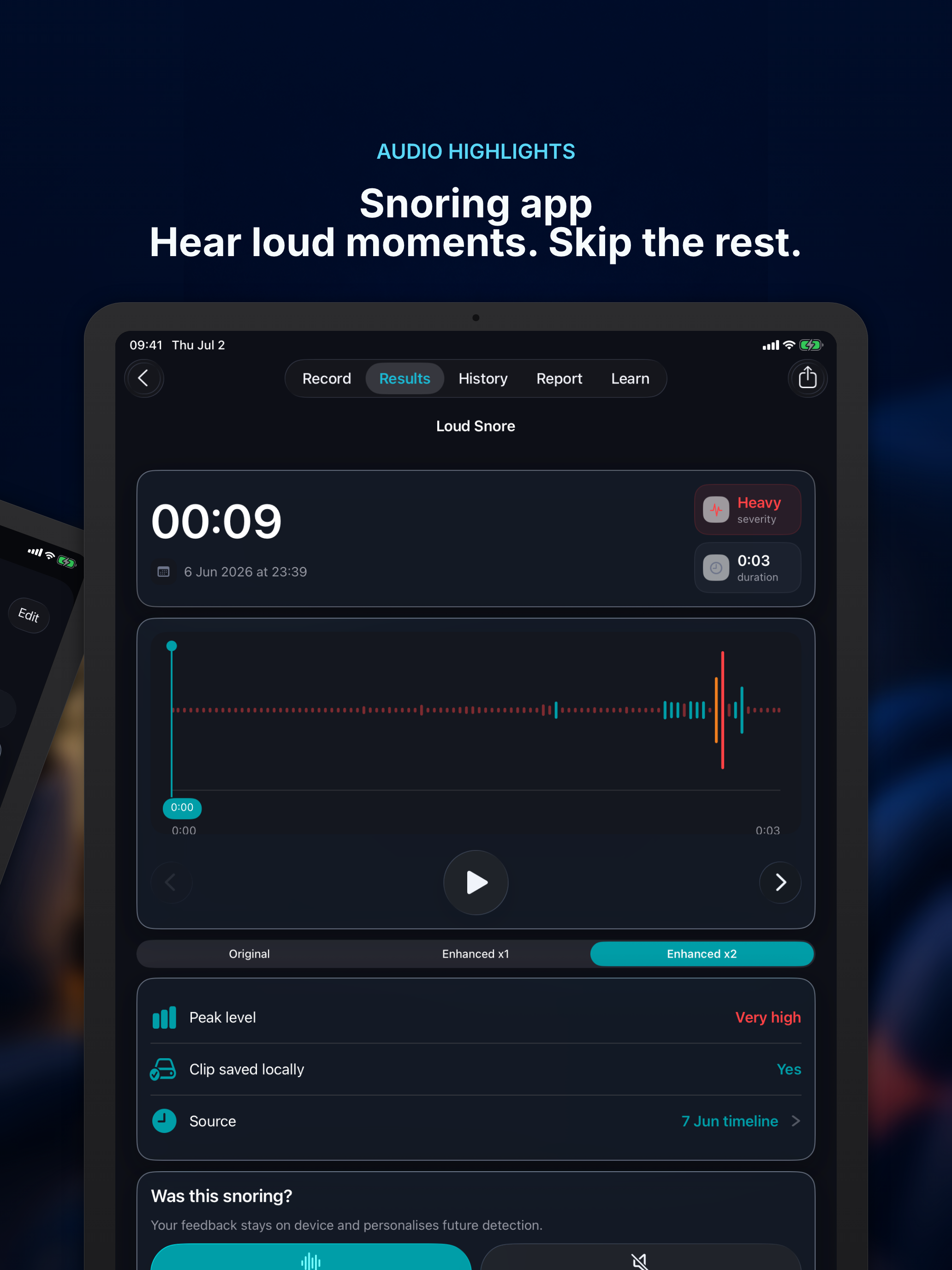 Sleep Recorder - Snore Clinic