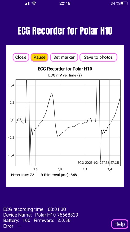 ECG Recorder for Polar H10 screenshot-5