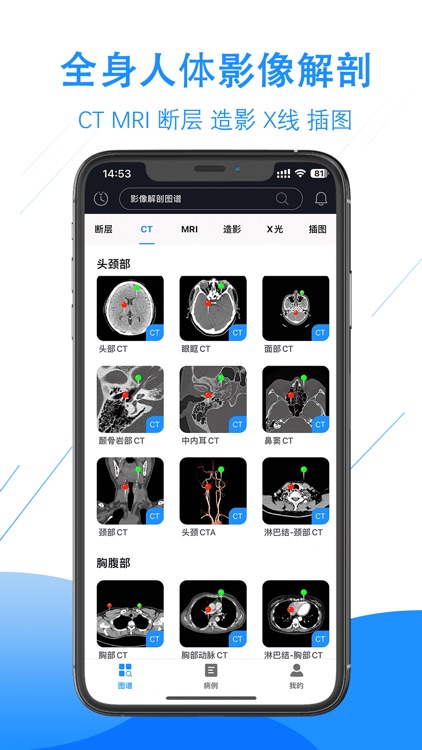 影像解剖图谱-人体断层影像图集和病例大全