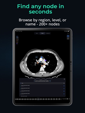 Lymph Atlas iPad screenshot