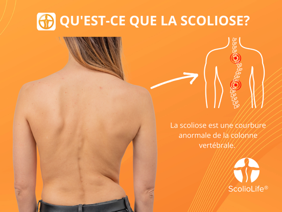 Screenshot #5 pour Scoliomètre