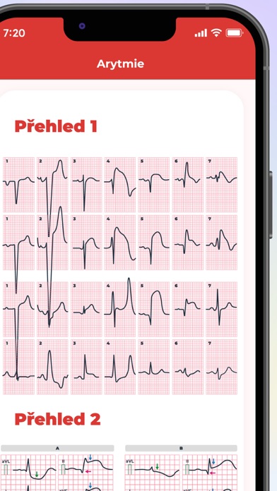 EKG: Snadno a rychle Screenshot