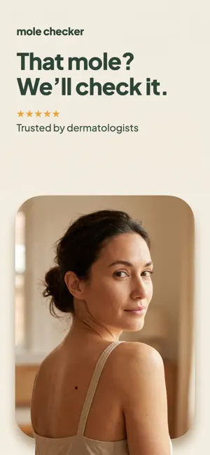 Mole Checker: Skin Scanner screenshot 1