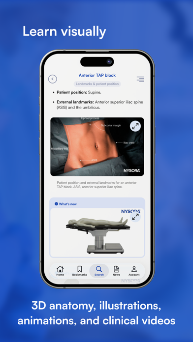 Screenshot #3 pour NYSORA Nerve Blocks