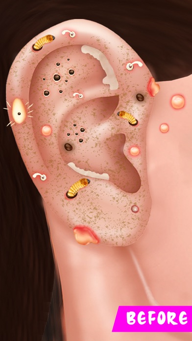 ASMR ドクター: 耳ピアス ゲームのおすすめ画像2