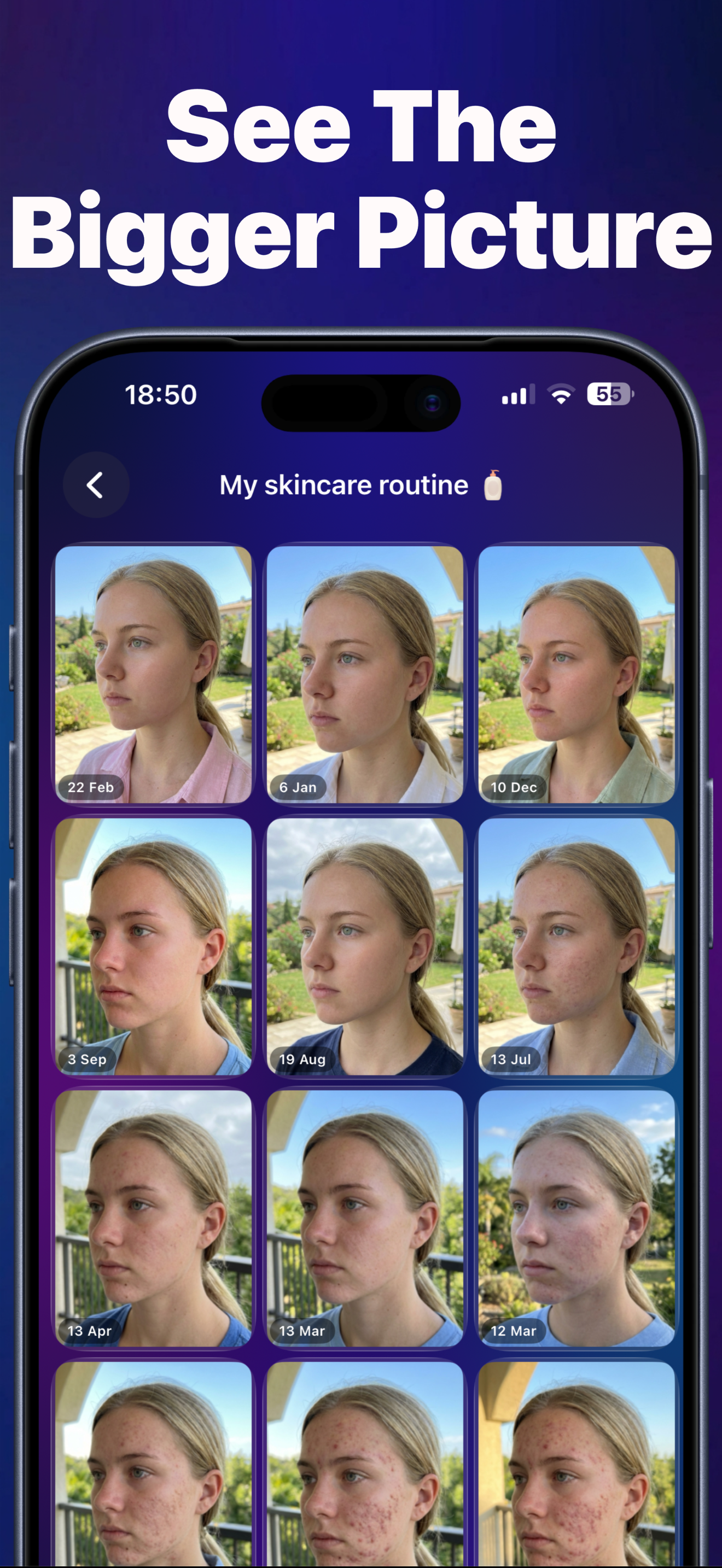 LUUQ - Progress Photos screenshot 7