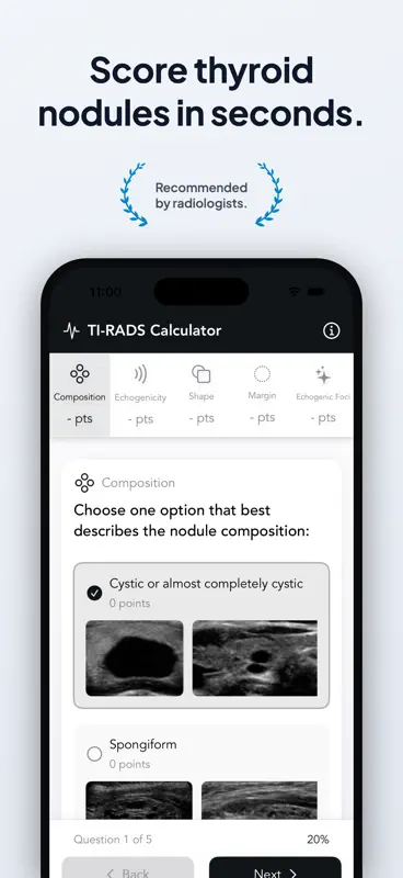 Calculadora TI-RADS Fácil screenshot 1 of 4