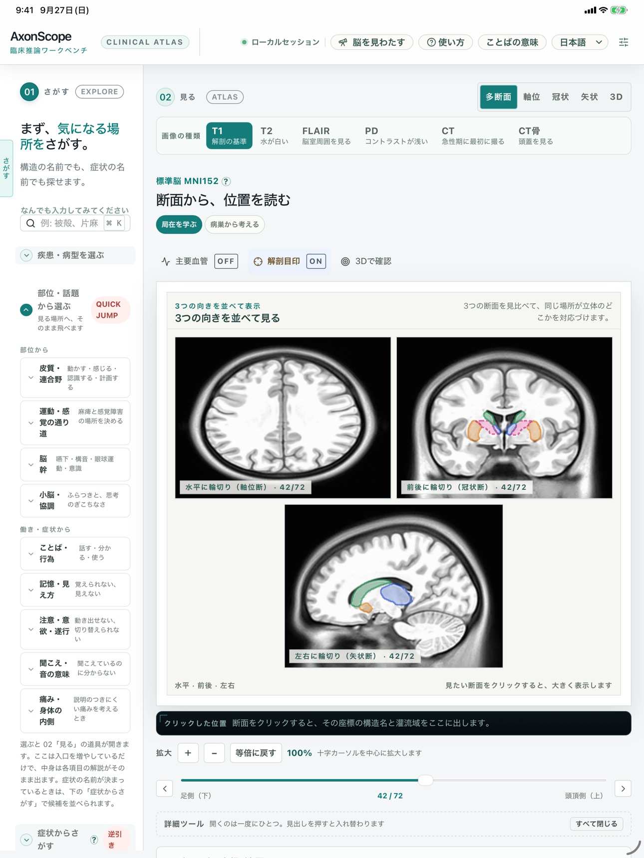 Screenshot 9 of AxonScope 脳画像と症状をつなぐ