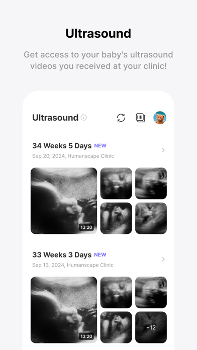 Momitalk: Pregnancy Ultrasound Screenshot