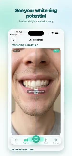 ScanDent: AI Dental Scanner screenshot 3
