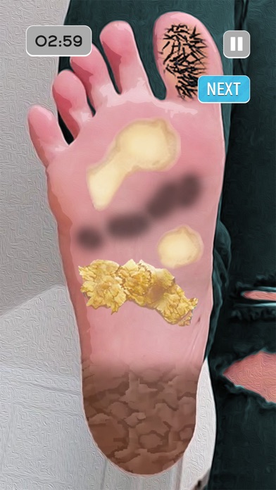 ASMR Foot Care: Doctor Games Screenshot