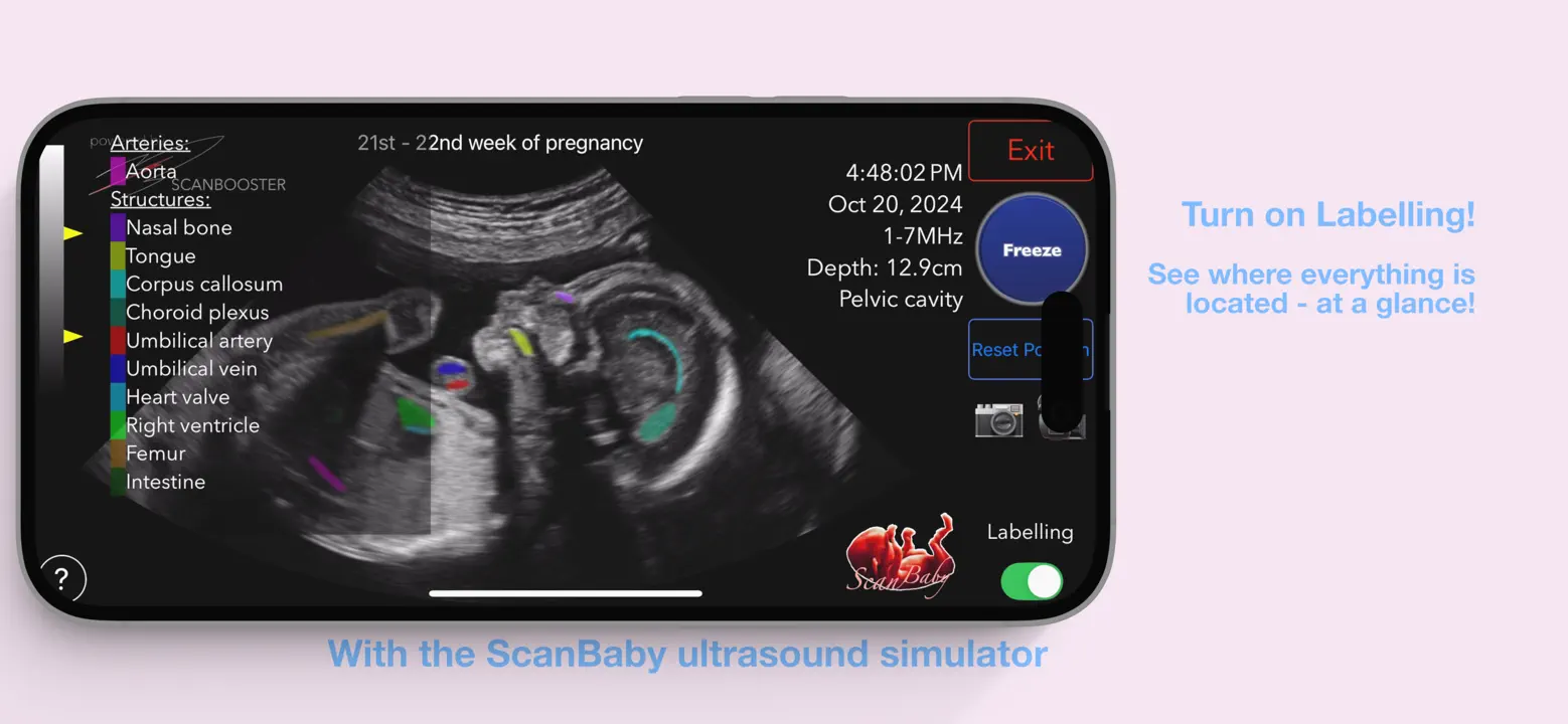 ScanBaby learn baby ultrasoundのスクリーンショット（6/8）