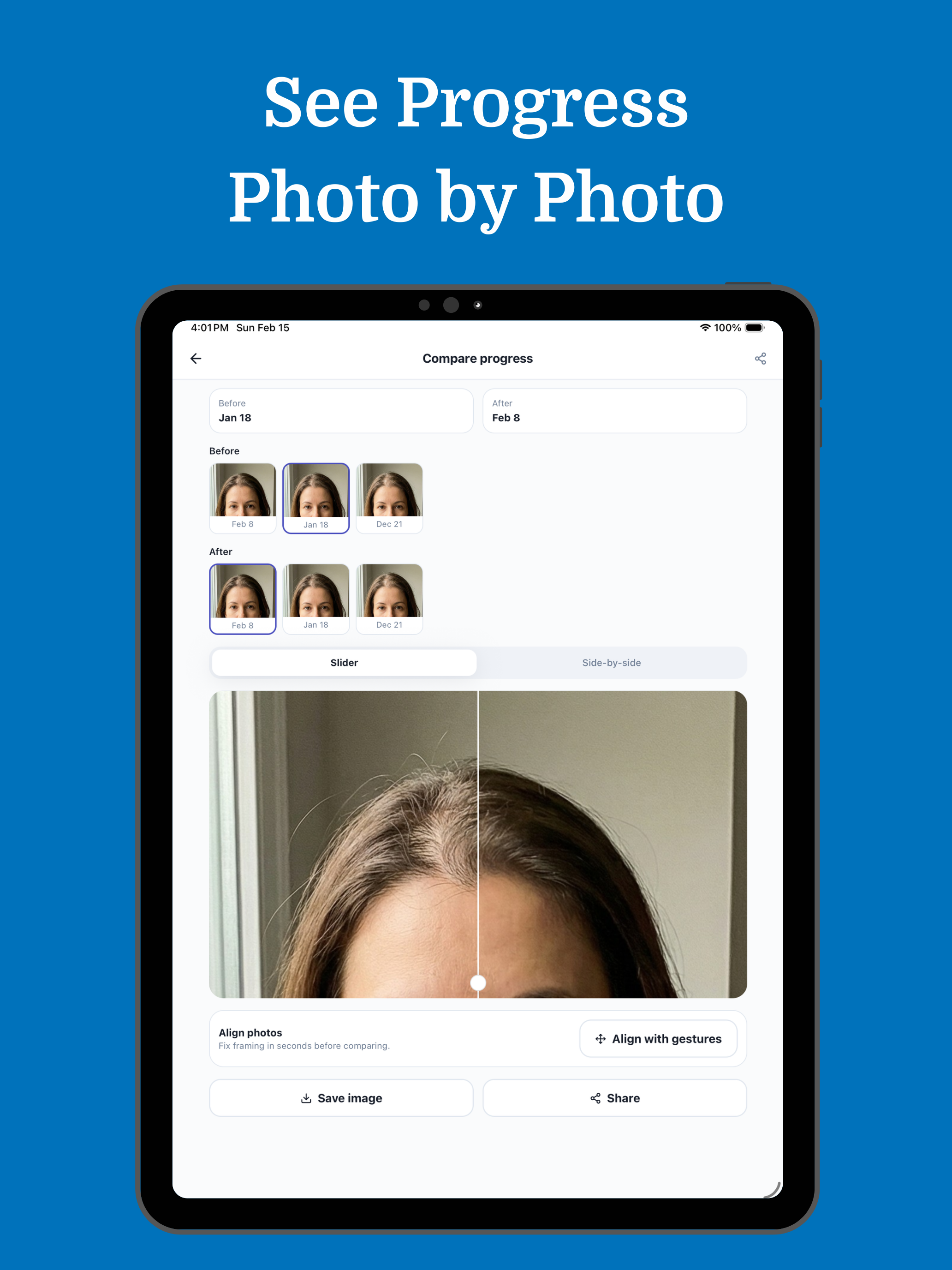 RiseCare: Postpartum Hair Loss