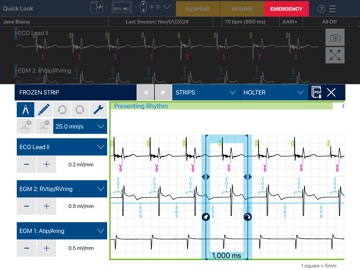 CareLink SmartSync™ US app screenshot