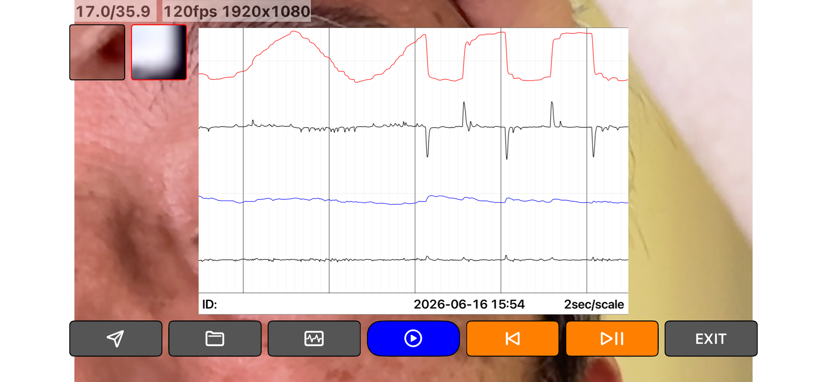 Eye Tracking Test screenshot 3